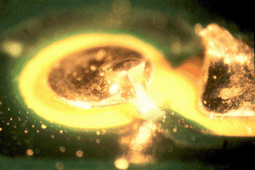 Figure 1: This lifted pad occurred during handling, right after wave soldering